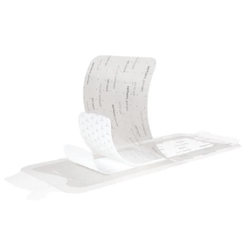Mepilex Border Post-Op Dressing